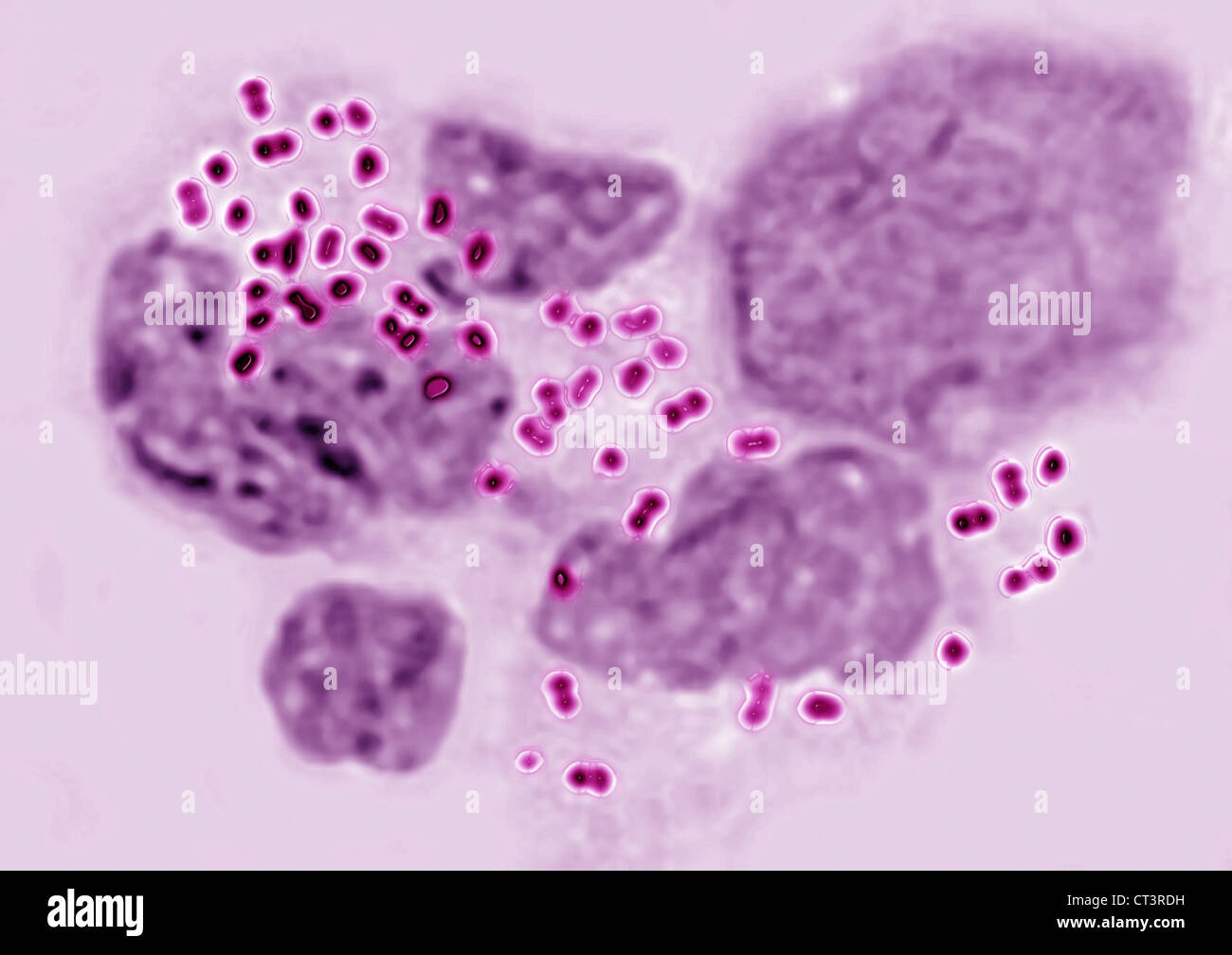 Neisseria Gonorrhoeae Stockfotos und bilder Kaufen Alamy