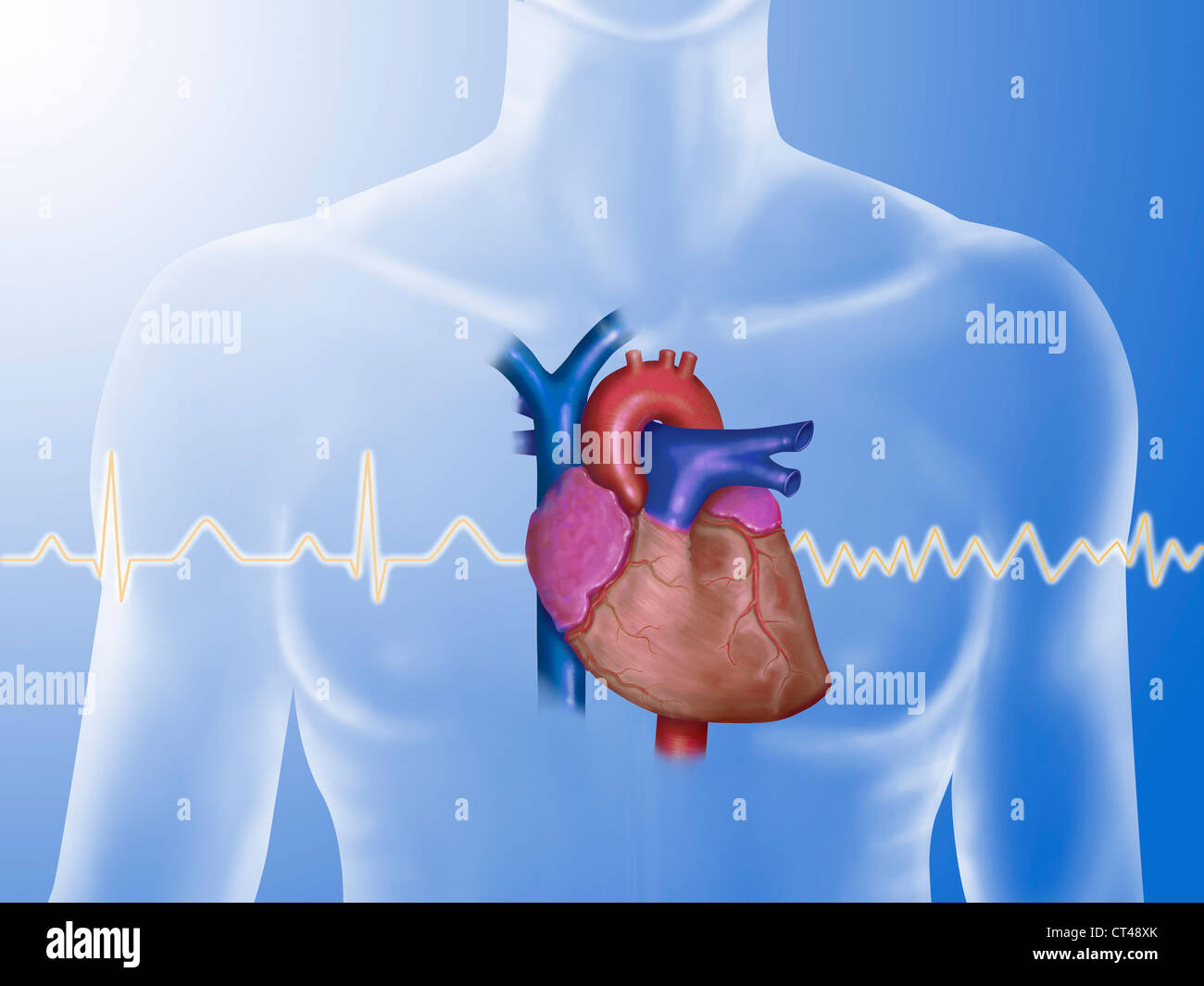 Arrhythmie Stockfotos und bilder Kaufen Alamy