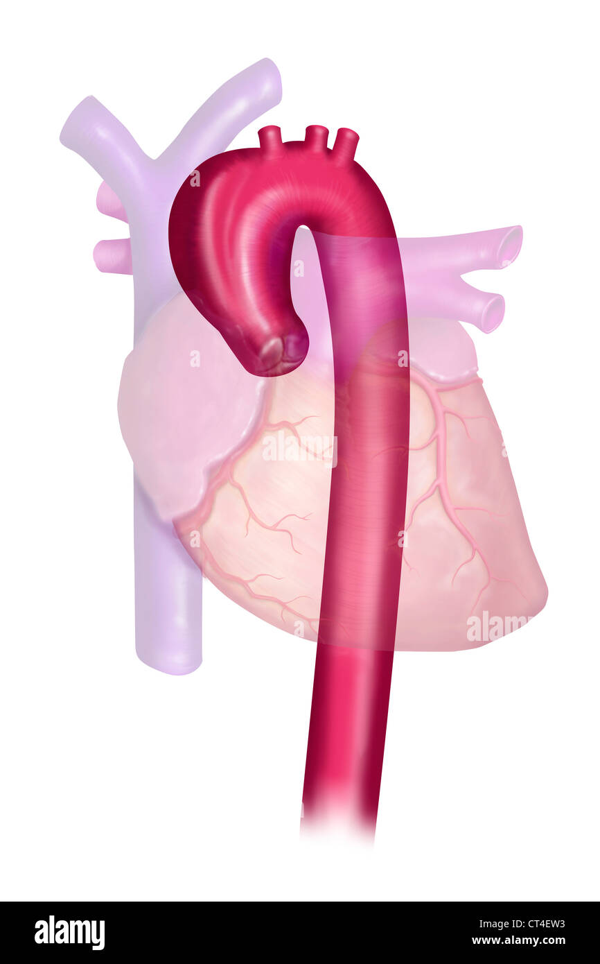 Aortic arch -Fotos und -Bildmaterial in hoher Auflsung  Alamy