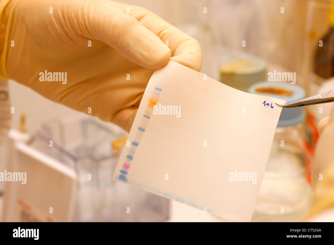 PROTEIN-ELEKTROPHORESE Stockfoto