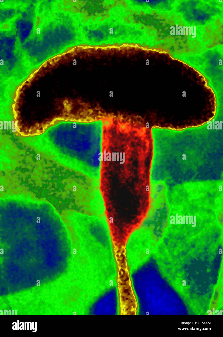 PROSTATA-ADENOM, X-RAY Stockfoto