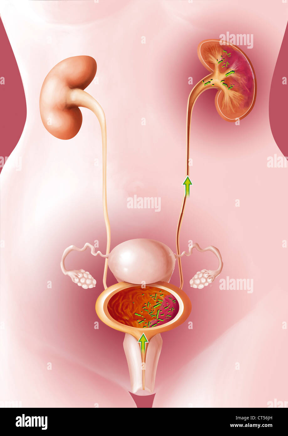 Pyelon Stockfotos und bilder Kaufen Alamy