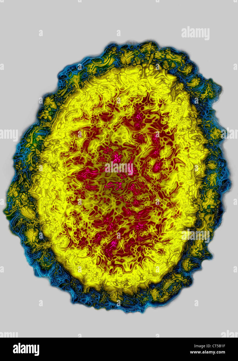 INFLUENZA A H1N1 VIRUS Stockfoto