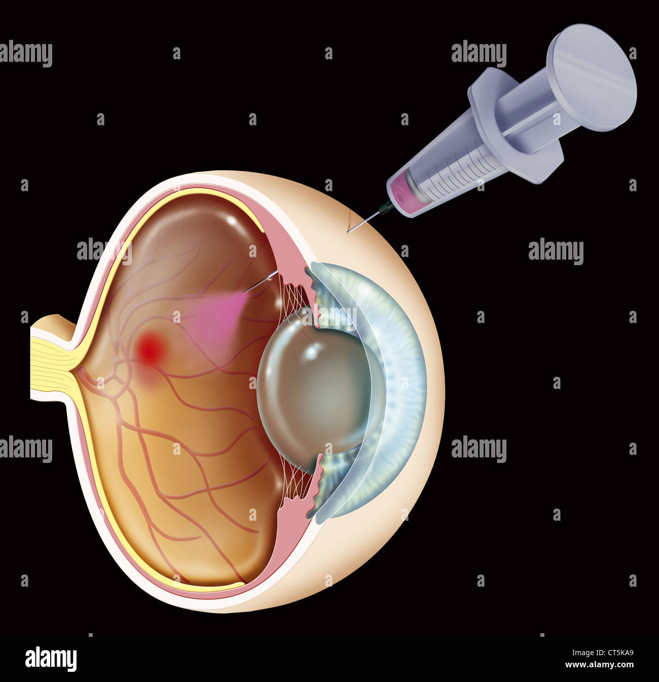 AMD BEHANDLUNG, ILLUSTRATION Stockfoto