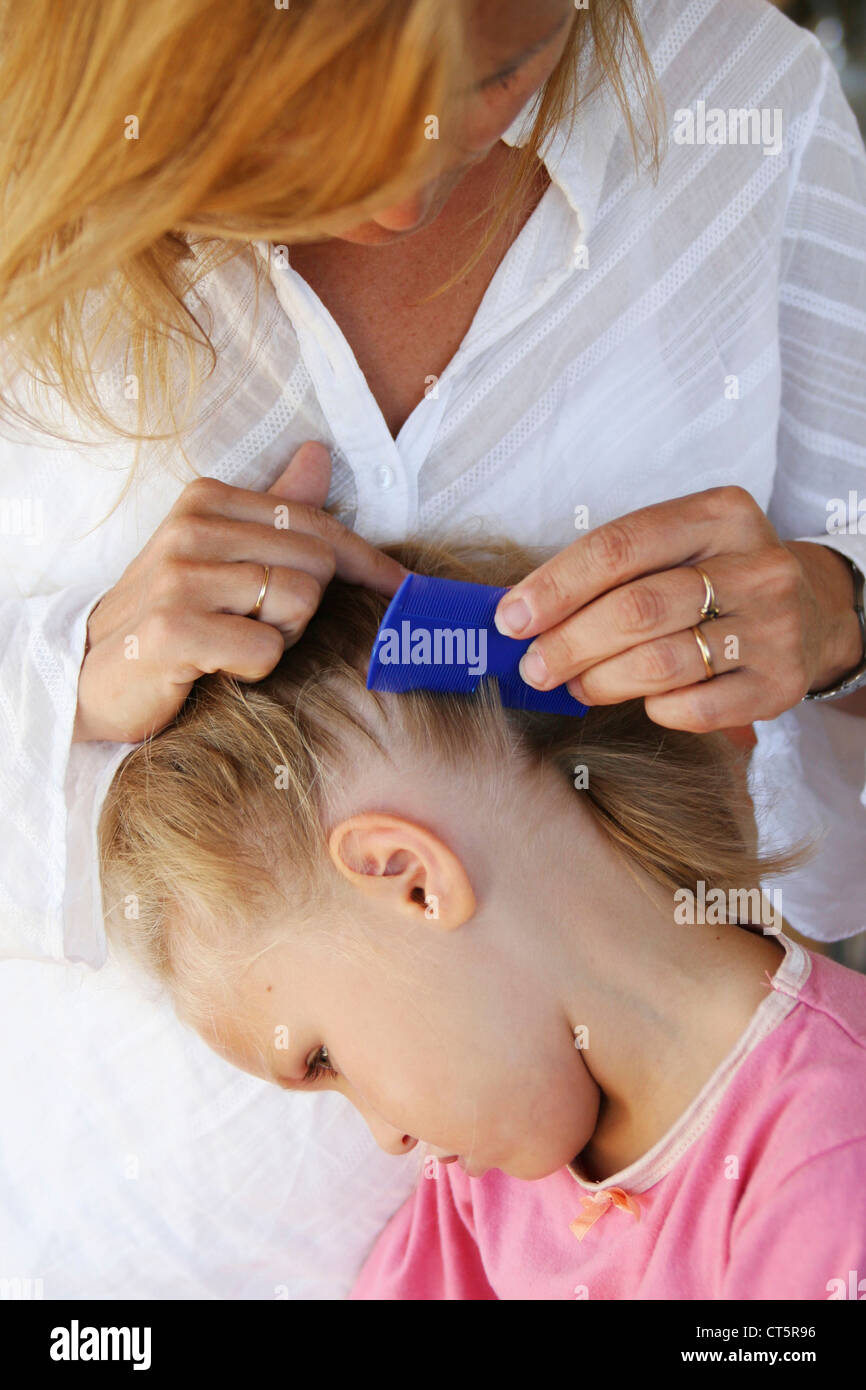 BEHANDLUNG VON LÄUSEN Stockfoto