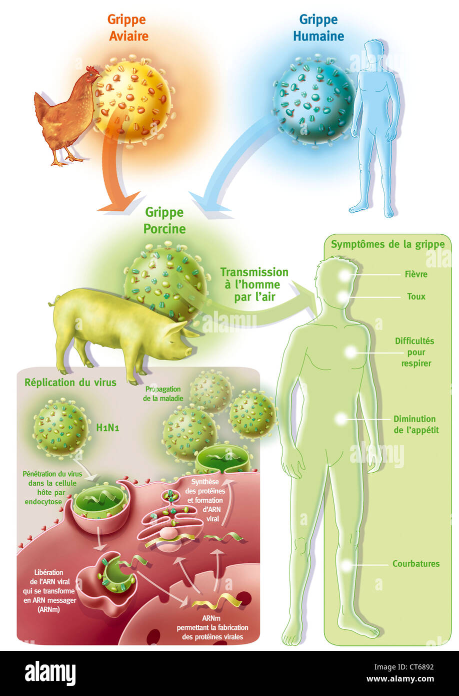 INFLUENZA A H1N1 INFEKTION Stockfoto