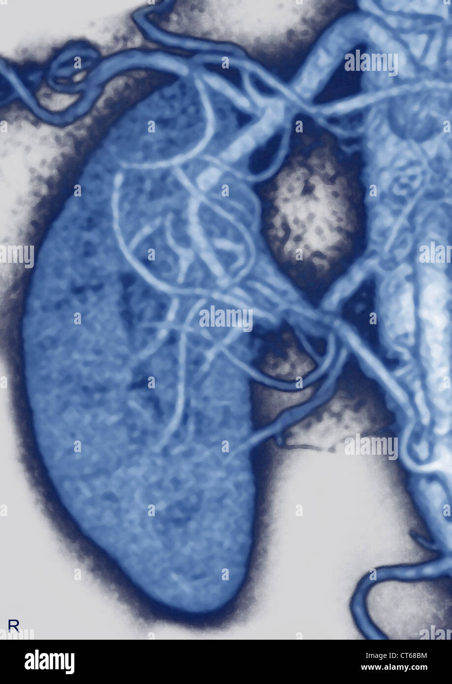 NIEREN-ARTERIE, 3D-SCAN Stockfoto