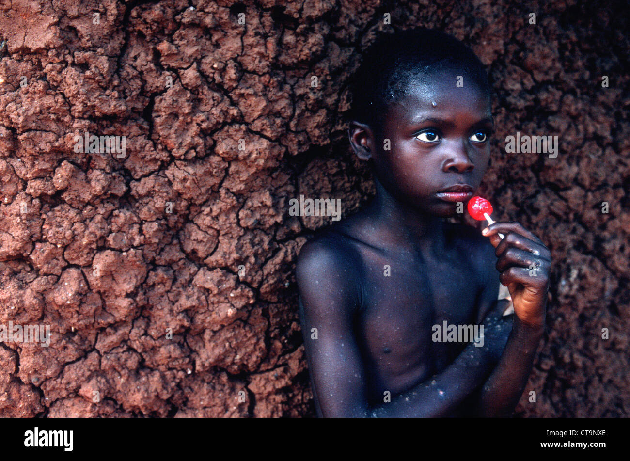 Swasiland-Porträt eines jungen, der an AIDS leidet Stockfoto