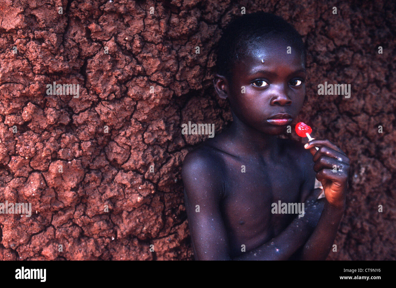 Swasiland-Porträt eines jungen, der an AIDS leidet Stockfoto