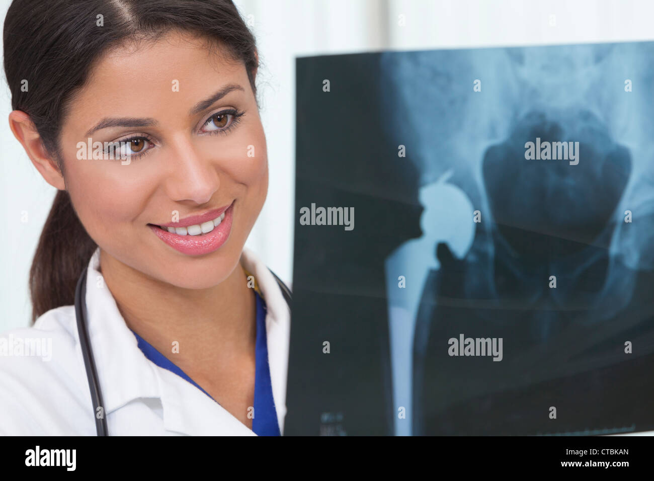 Weibliche Frau Doktor der Medizin halten künstliche Hüftersatz Röntgen im Krankenhaus Stockfoto