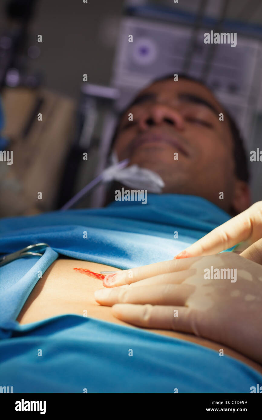 Unbewussten männlichen Patienten auf einem Operationstisch Stockfoto