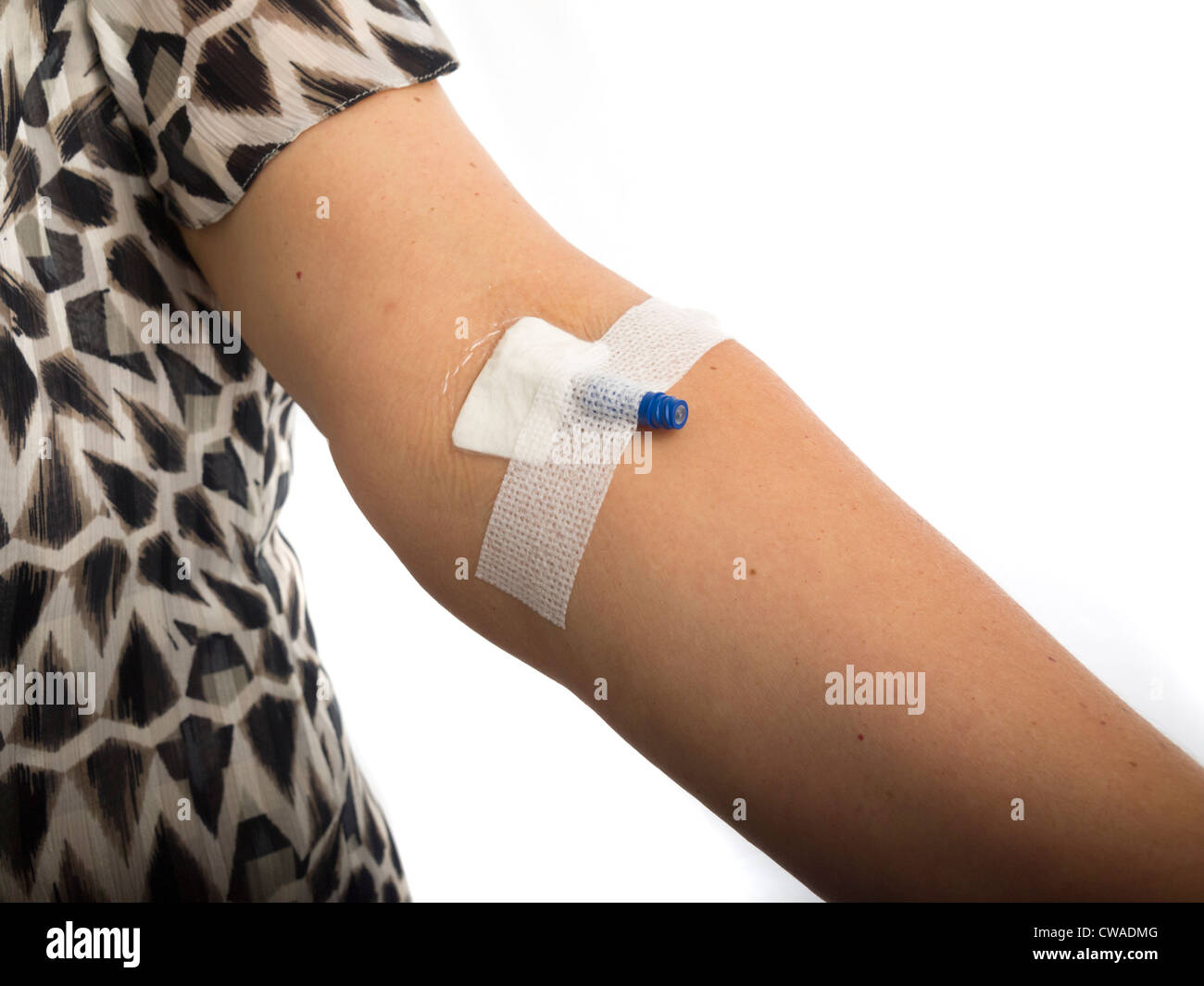 Arm des Patienten mit Tropf Stockfoto