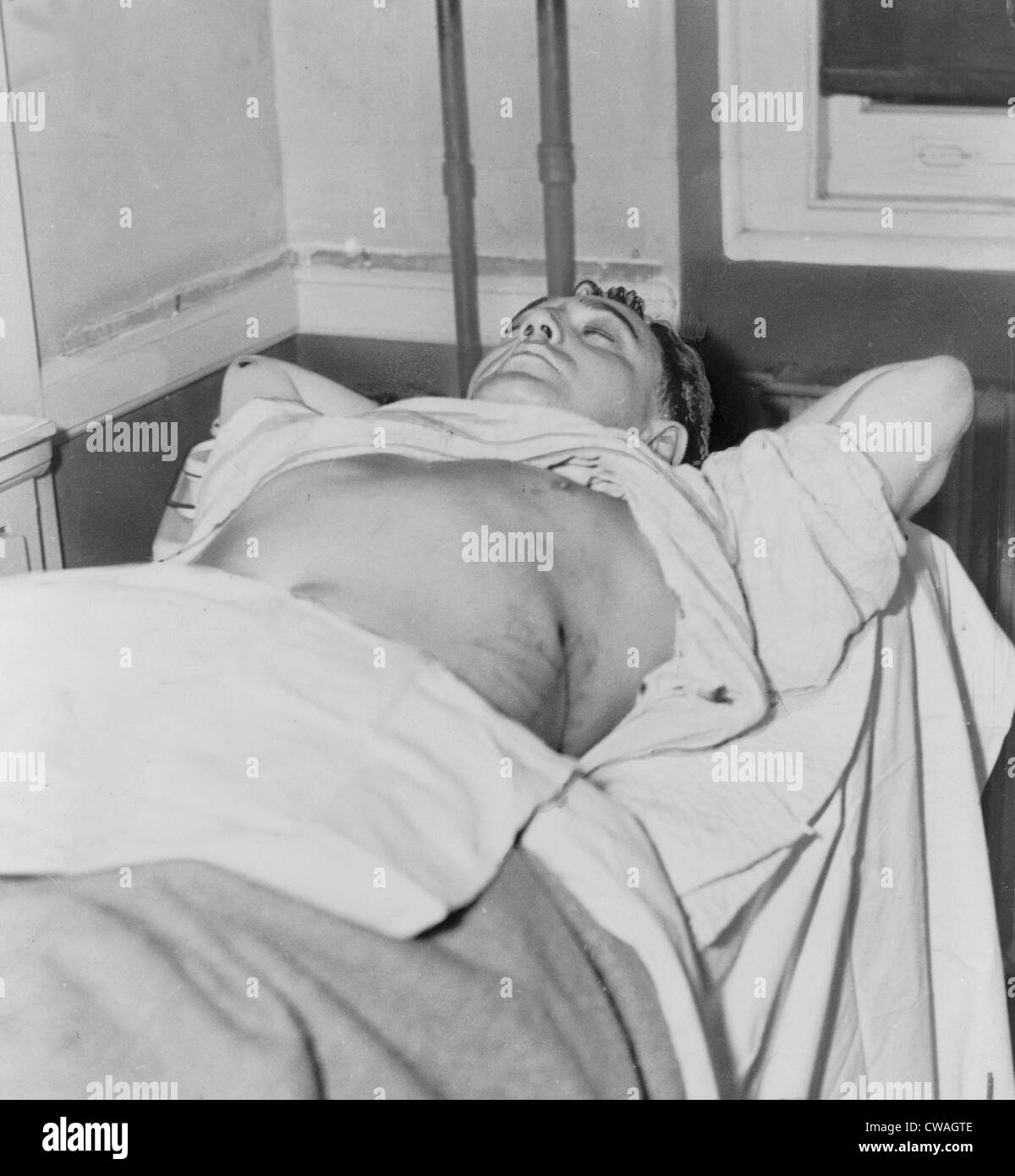 Dutch Schultz, geb. Arthur Flegenheimer (1902 – 1935), im städtischen Krankenhaus in Newark, New Jersey, nachdem er angeschossen Verwundeten liegend Stockfoto