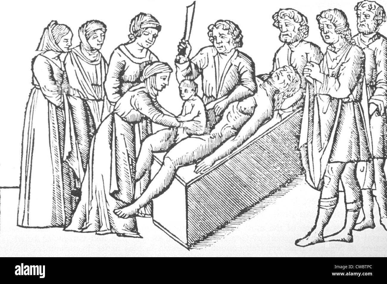 Abbildung der Geburt von Julius Caesar, per Kaiserschnitt aus einer 1506  Ausgabe des Sueton, der zwölf CESARS. Die Frau ist tot und ein Chirurg  steht neben dem Körper halten einen Rasierer, wie