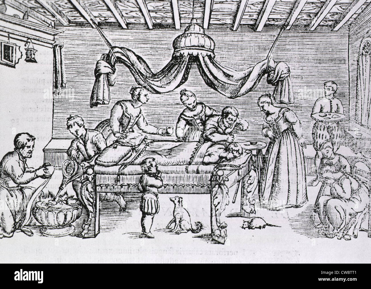 Hirn-OP im 16. Jahrhundert.  Ein Chirurg bohrt ein Loch in den Schädel des Patienten, während mehrere Assistenten führen Sie verschiedene Stockfoto