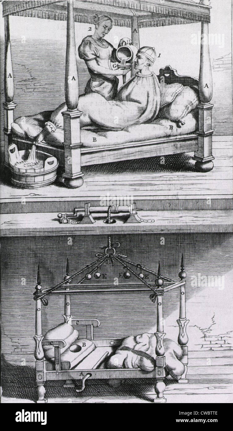 Fieber-Tasche aus dem 17. Jahrhundert. Oben eine Frau bereitet sich auf kaltes Wasser in Gießen an der Tasche am Hals des Patienten, die kühlen wird Stockfoto