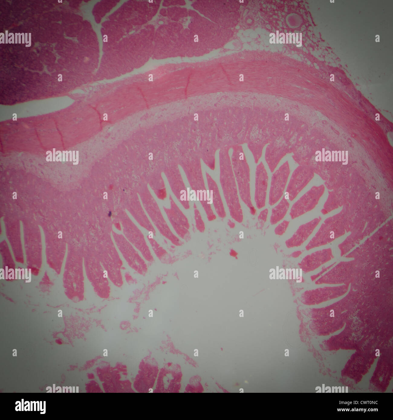 medizinische Anthropotomy Physiologie mikroskopische Wissenschaftsabschnitt der kleinen Intestinum Tenue Gewebe Stockfoto