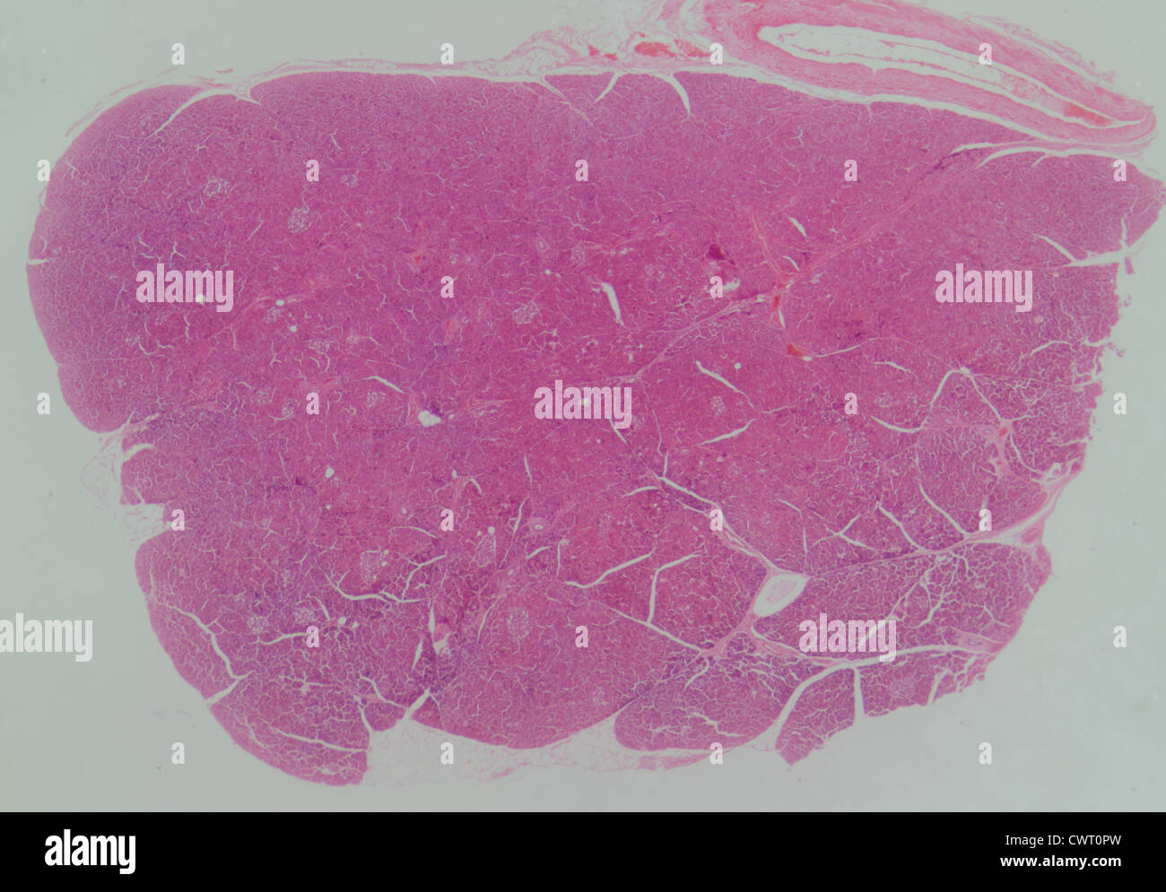 medizinische Anthropotomy Physiologie mikroskopische Wissenschaftsabschnitt des Pankreas-Gewebe Stockfoto