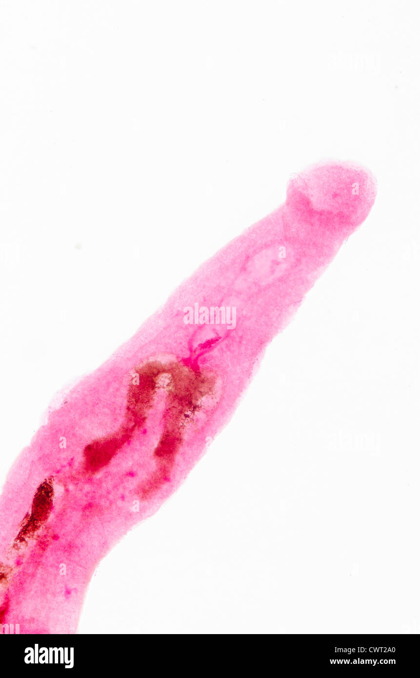 medizinischen Mikroskopie tierischen Parasiteras schistosome-Blut Egel Stockfoto