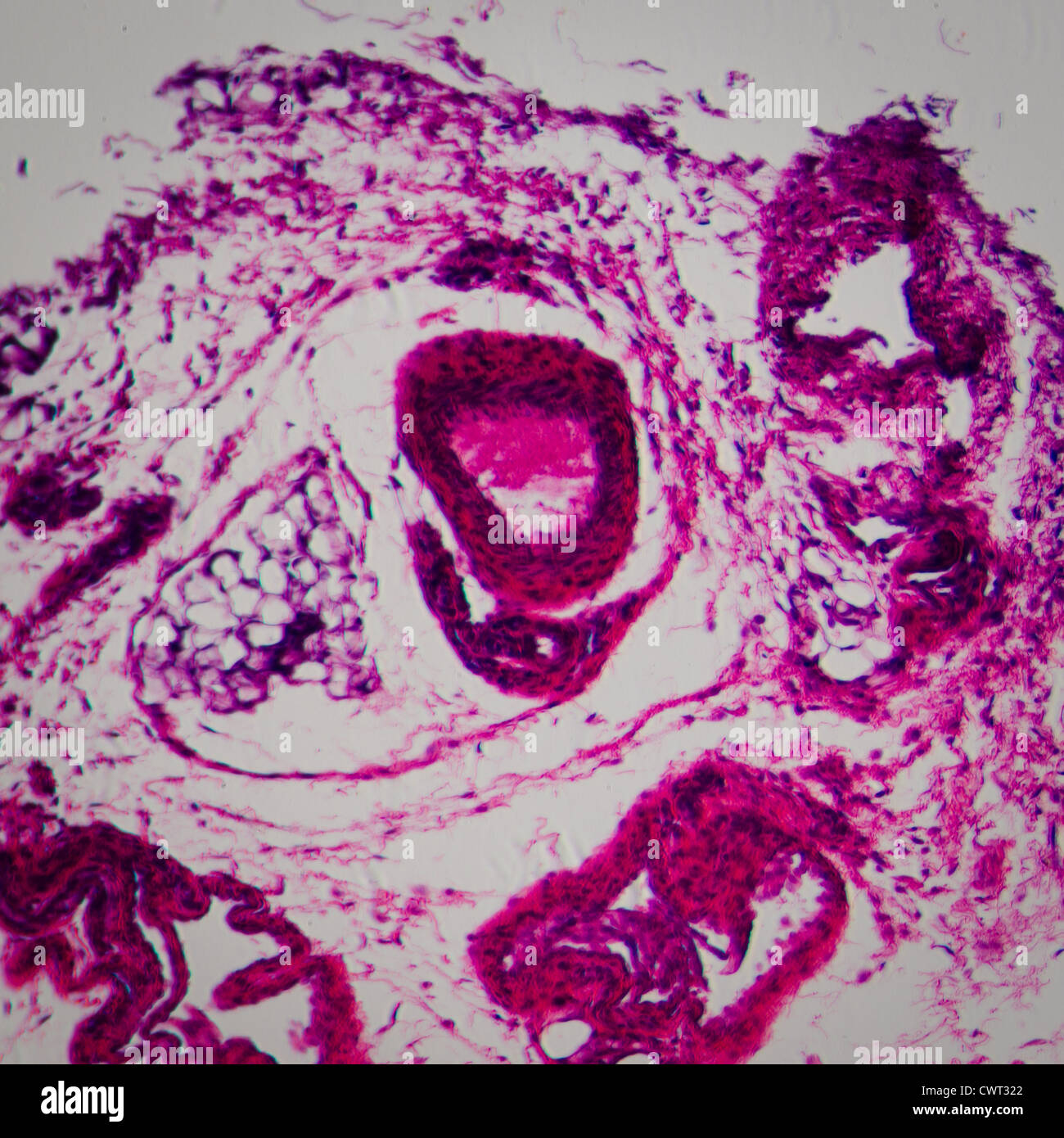 medizinische Anthropotomy Physiologie mikroskopische Wissenschaftsabschnitt der Lymphe Drüse Gewebe Hintergrund Stockfoto