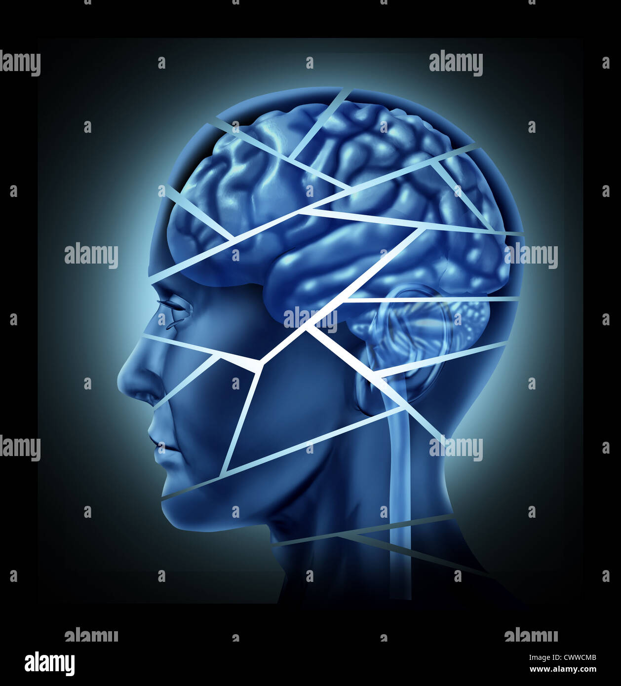 Hirn-Trauma und neurologische Störung, die durch einen menschlichen Kopf und Verstand in Stücke gebrochen, symbolisiert eine schwere medizinische psychisches Trauma und kognitive Krankheit dargestellt. Stockfoto