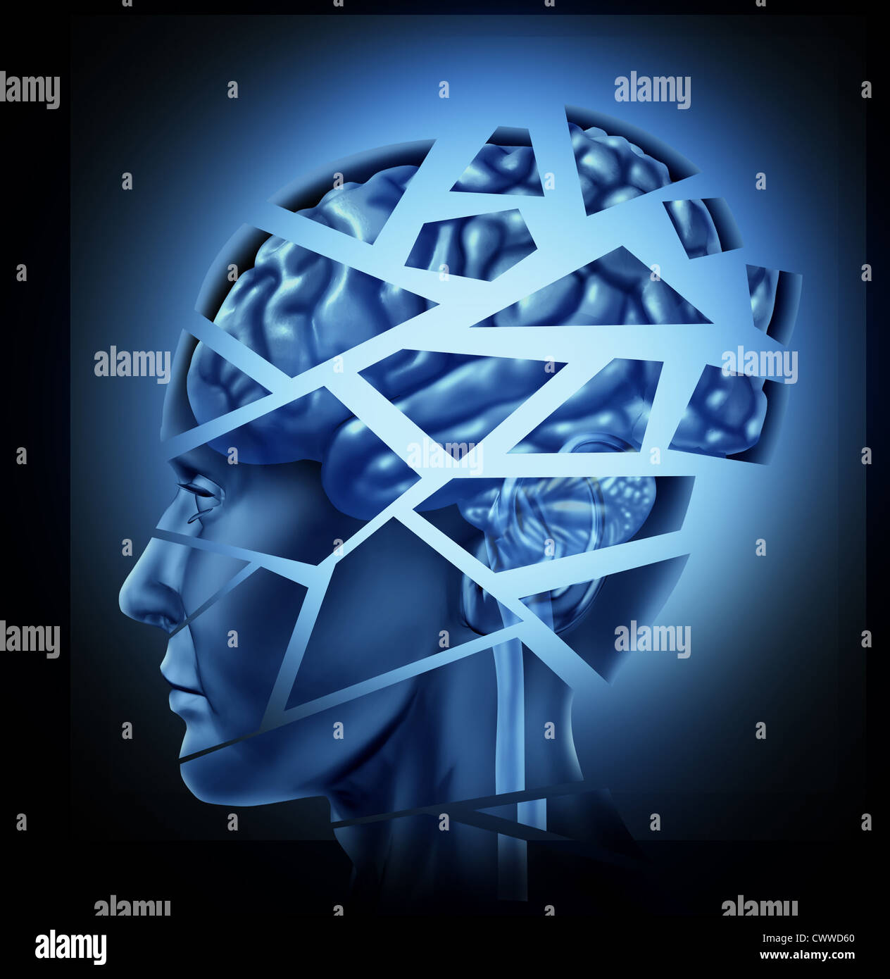 Beschädigte menschliche Hirn-Trauma und neurologische Störung, die durch eines Mannes Kopf und Verstand in Stücke gebrochen, symbolisiert eine schwere medizinische psychisches Trauma und kognitive Krankheit auf schwarzem Hintergrund dargestellt. Stockfoto