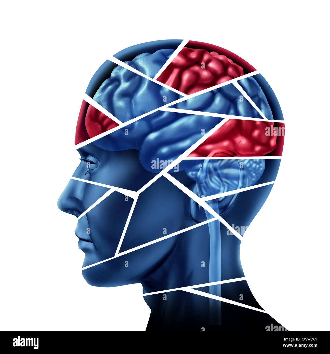 Psychischen Störungen und neurologischen Verletzung durch einen menschlichen Kopf und Verstand in Stücke zu einem schweren medizinischen Menta symbolisieren gebrochen Stockfoto