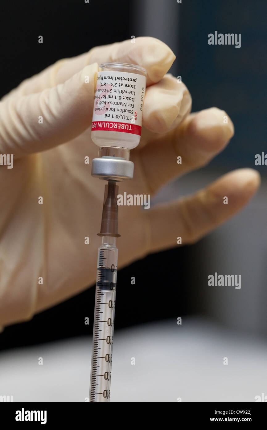 Mantoux Impfstoff gegen Tuberkulose testen Stockfoto