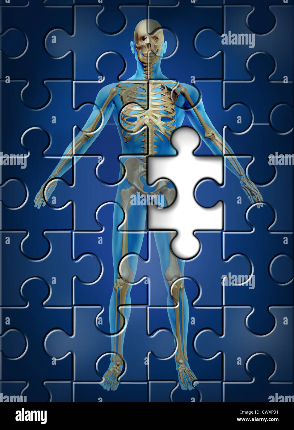 Und menschliche Skelett Herzkrankheiten und Osteoporose des Begriffs Hüftknochen mit einem Puzzle-Textur und ein fehlendes Stück als Symbol der orthopädischen und alternde Verschlechterung Krankheit Medizin und Gesundheitswesen. Stockfoto