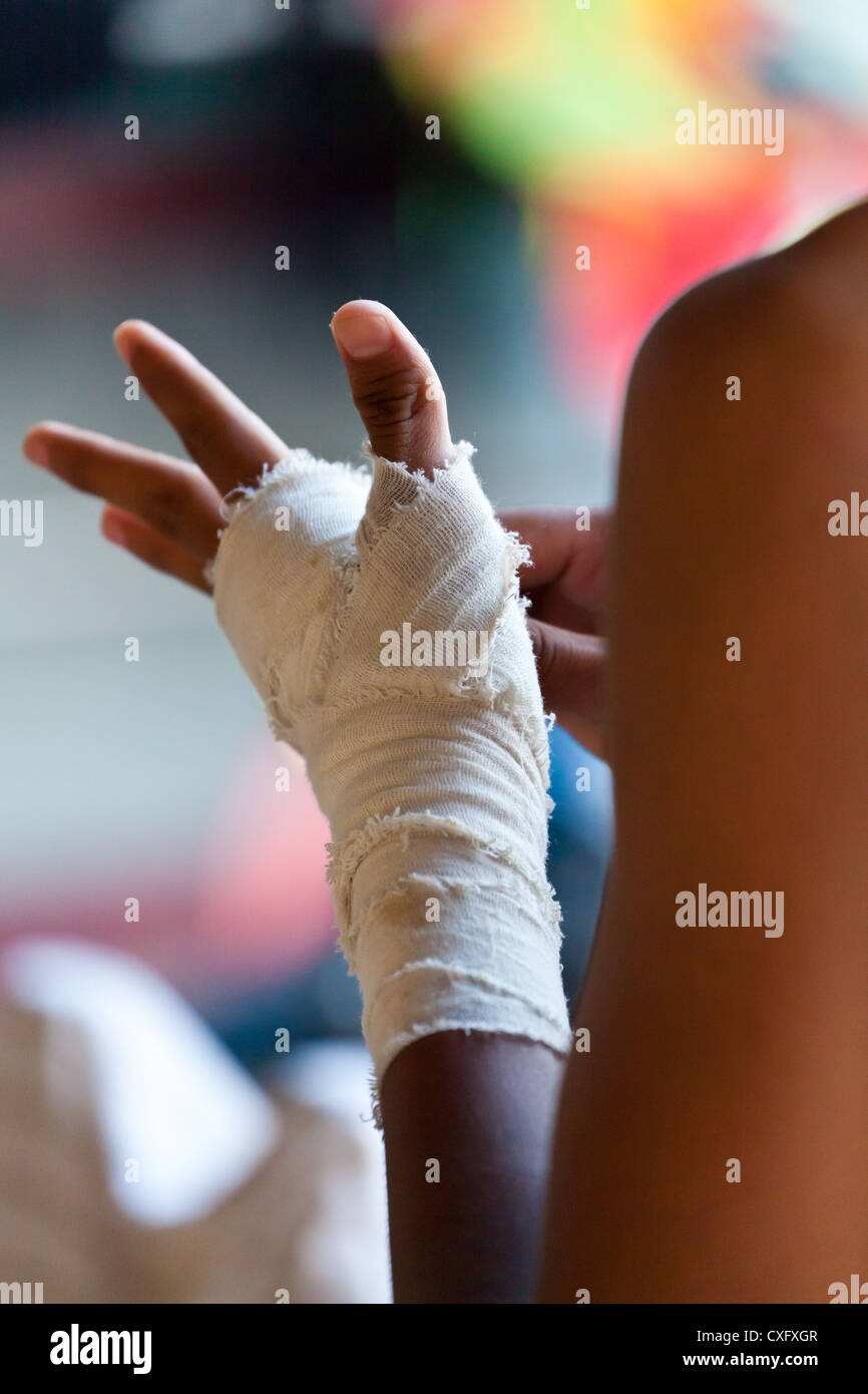 Bandagierte Hand von einem Thai-Boxer auf Phuket Stockfoto