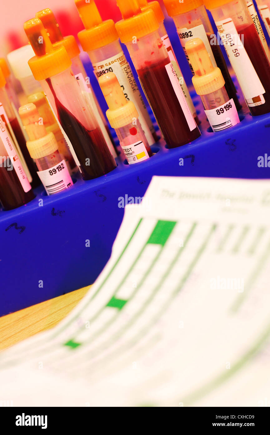 Blutproben zusammen mit grünen Formulare in einer Pathologie-Labor im Krankenhaus UK Stockfoto