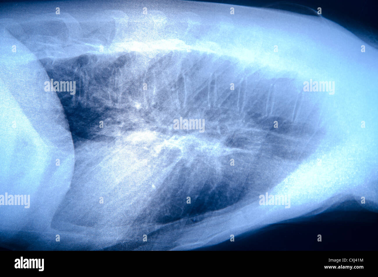 x-ray menschlicher Muskel Stockfoto
