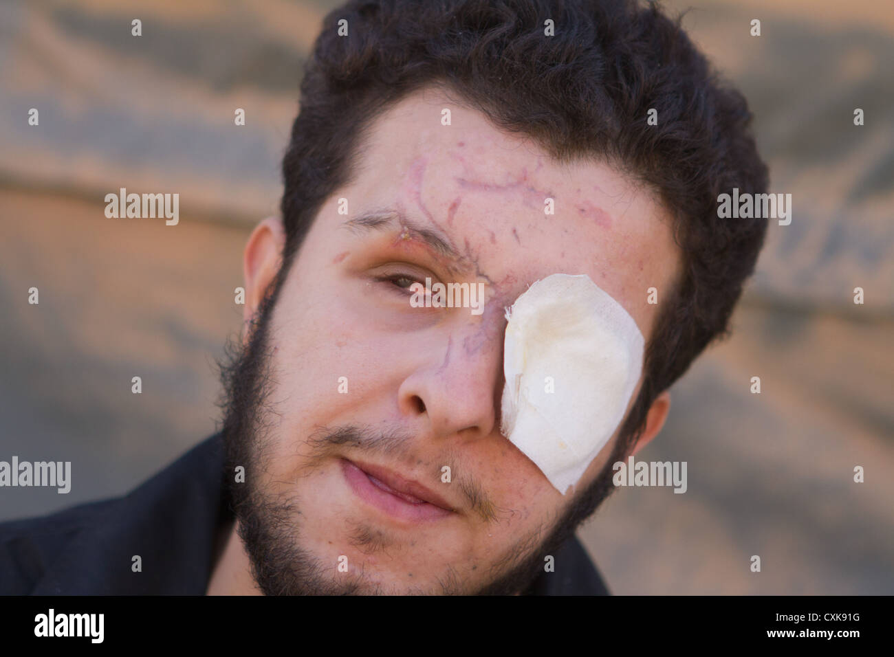Abdel Gafur Homsy ein ehemaliger freie syrische Armee (FSA) Kämpfer aus Homs in der marokkanischen medizinische und chirurgische Feldlazarett sitzt ein Stockfoto
