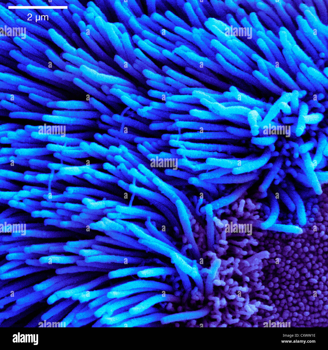 Scanning Electron Schliffbild der Lunge Luftröhre Stockfoto