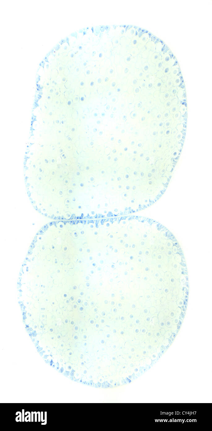 Mitose Pferd Ascaris Ei unter dem Mikroskop, Hintergrund (Ascaris Lumbricoides) Stockfoto