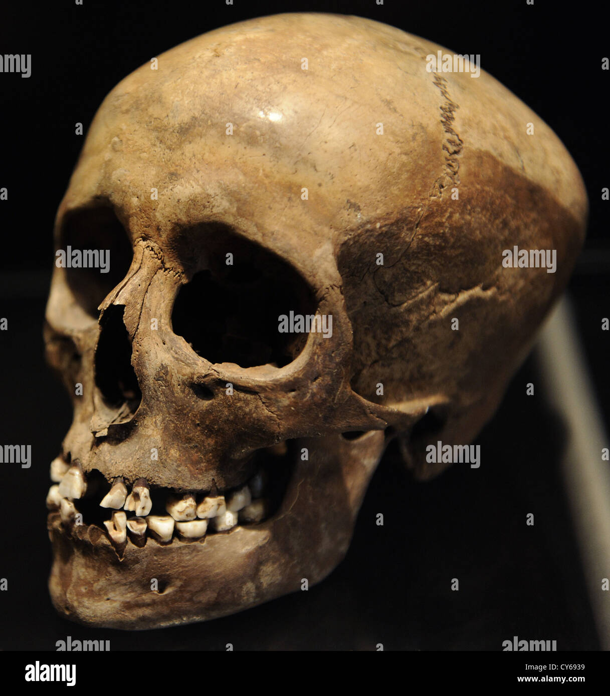 Schädel eines jungen Mädchens. 16 Jahre alt. 3500-3400 V. CHR.. Sigersdal Mose, Nord Seeland. National Museum of Denmark. Stockfoto