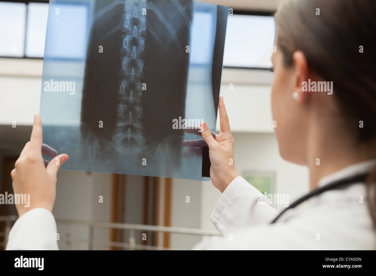 Ärztin, x-ray hochhalten Stockfoto
