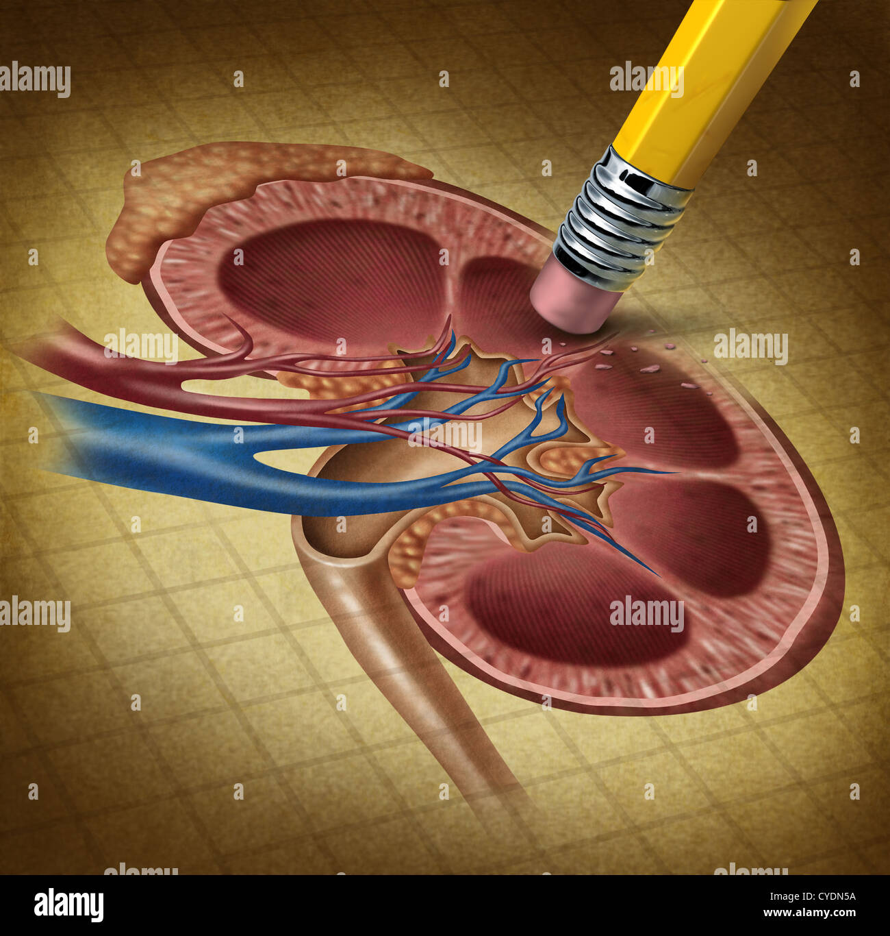 Menschliche Nierengesundheit und einen Rückgang der Nebenniere Funktion verursacht Probleme für die Harnwege wie ein Radiergummi Löschen einer alten Grunge medizinische Illustration auf Pergamentpapier zu verlieren. Stockfoto