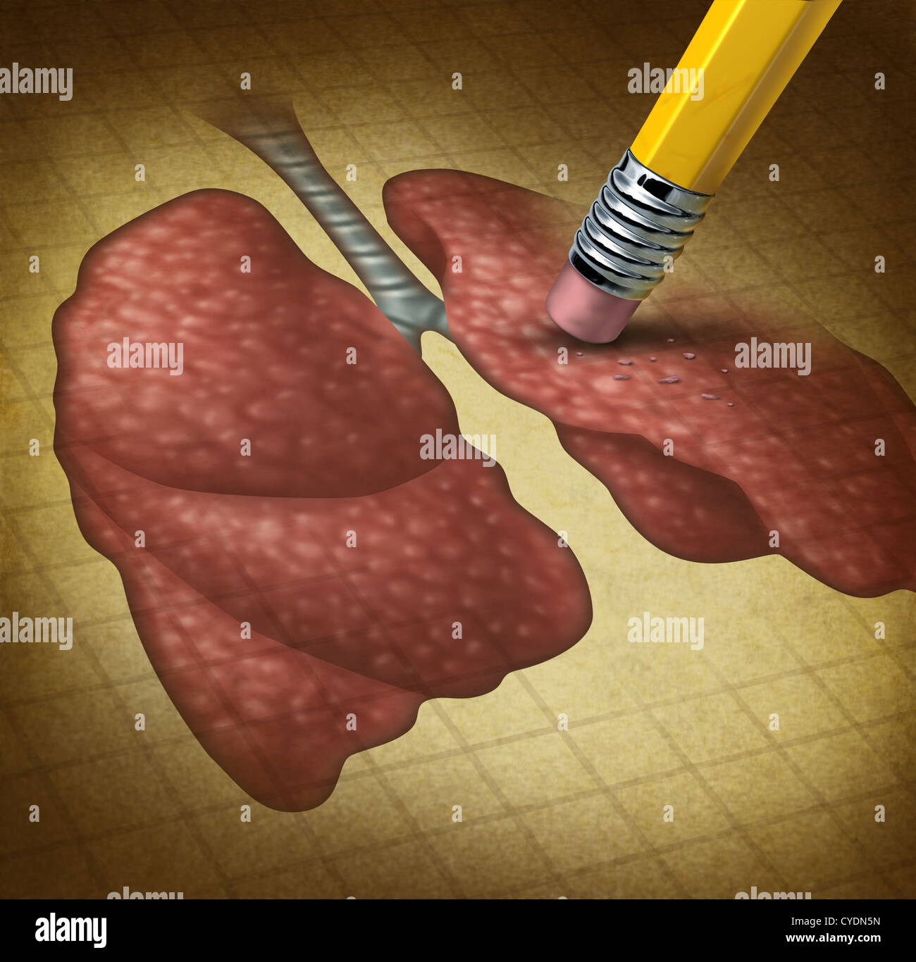 Menschliche Lunge Gesundheit und einen Rückgang der Atemfunktion, verursacht durch Krebs oder Krankheit als ein Radiergummi Löschen einer alten Grunge medizinische Illustration auf Pergamentpapier zu verlieren. Stockfoto
