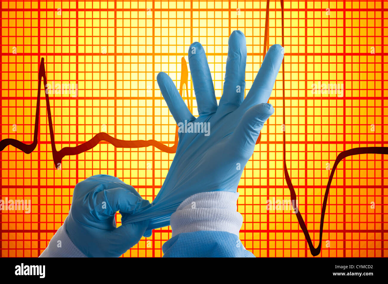 OP-Handschuhe EKG Hintergrund installiert wird Stockfoto
