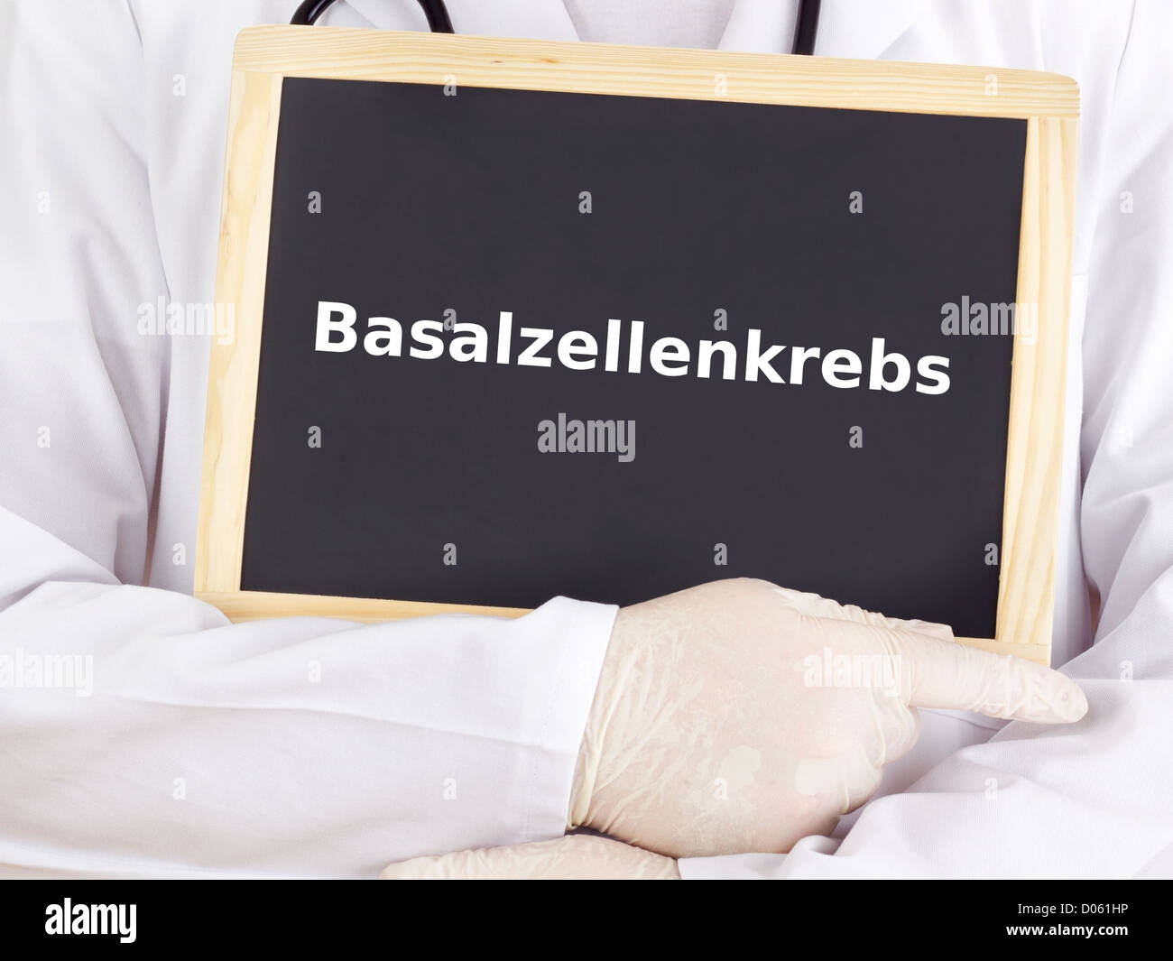 Arzt zeigt Informationen: basal Cell Carcinoma Stockfoto