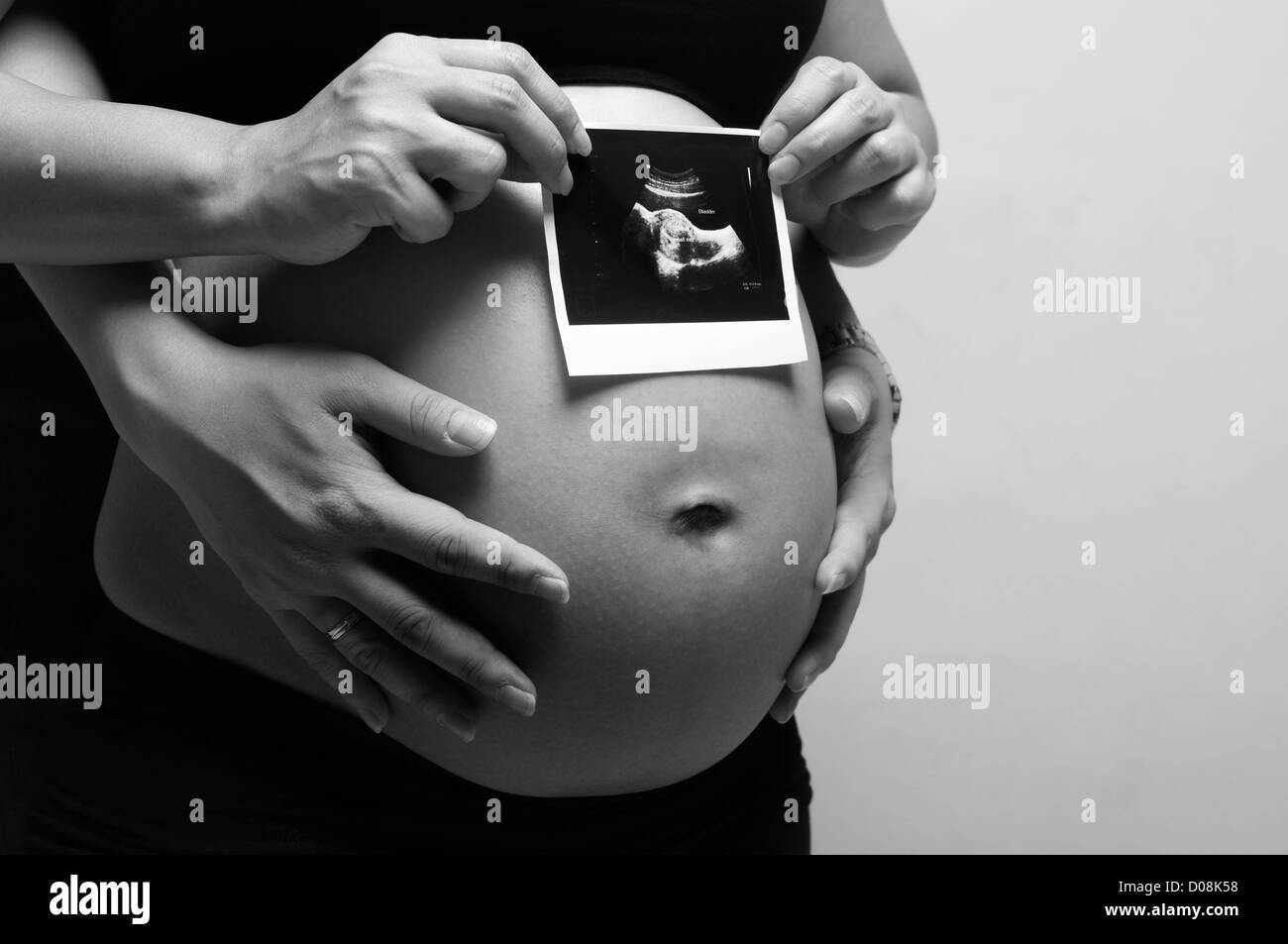 Ein Schuss von einer schwangeren Frau mit Mann hält Ultraschalluntersuchung des ungeborenen Kindes Stockfoto