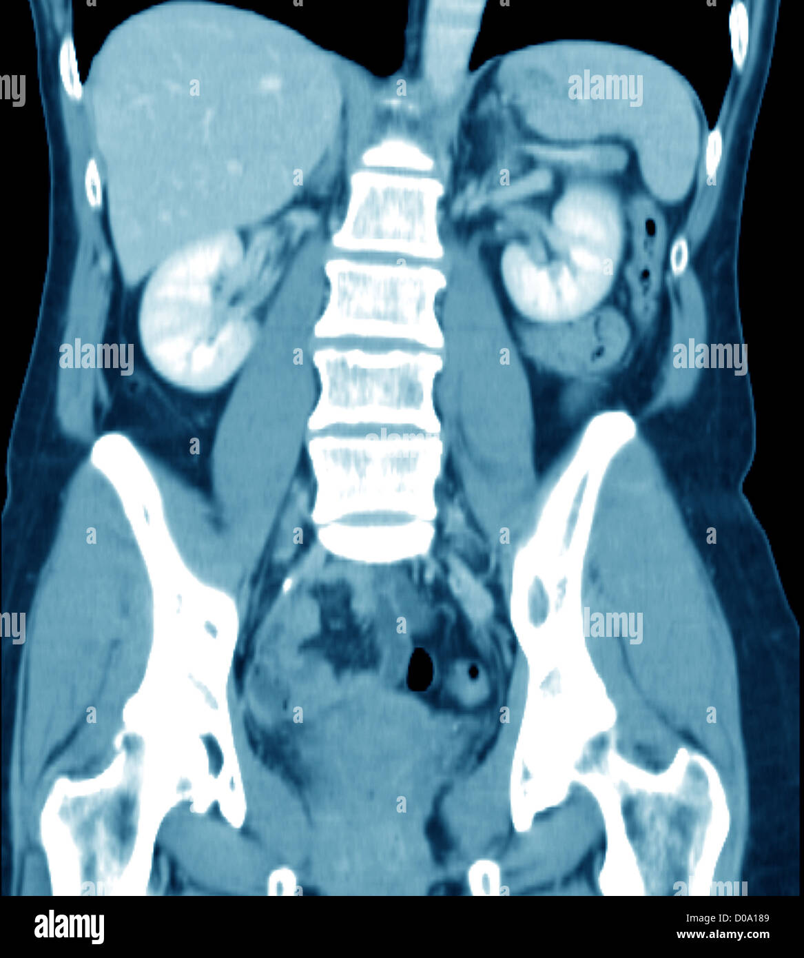BAUCH, SCAN Stockfoto