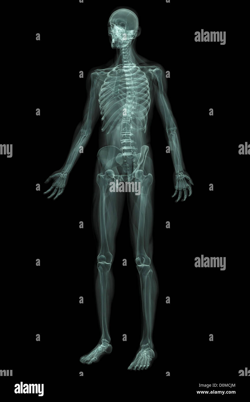 Röntgenbild zeigt den gesamten menschlichen Körper Stockfotografie - Alamy