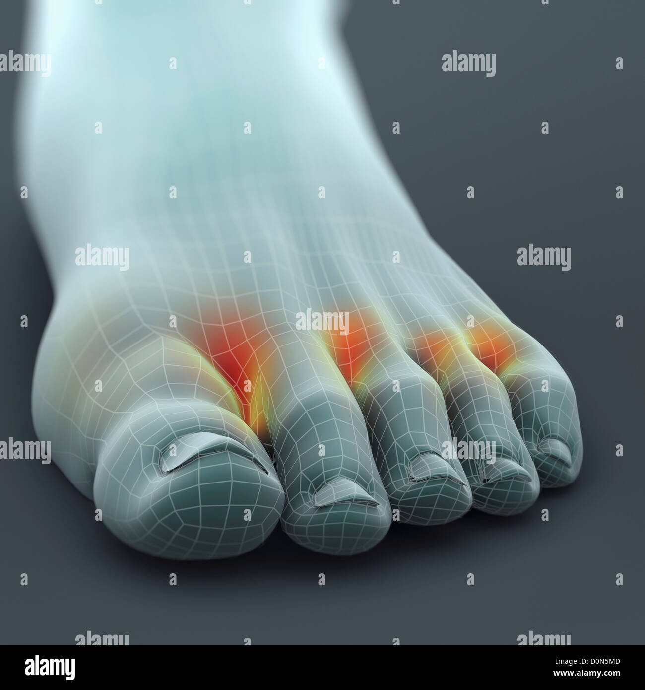 Ein linker Fuß Wireframe aussehen. Fuß ist hervorgehobenen Stellen Präsenz Pilzinfektion Fußpilz genannt. Stockfoto