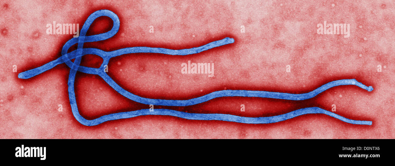 Dieser eingefärbte Transmission Electron Schliffbild (TEM) ergab, dass einige Ultrastrukturforschung Morphologie Ebola Virus Virion angezeigt. Stockfoto