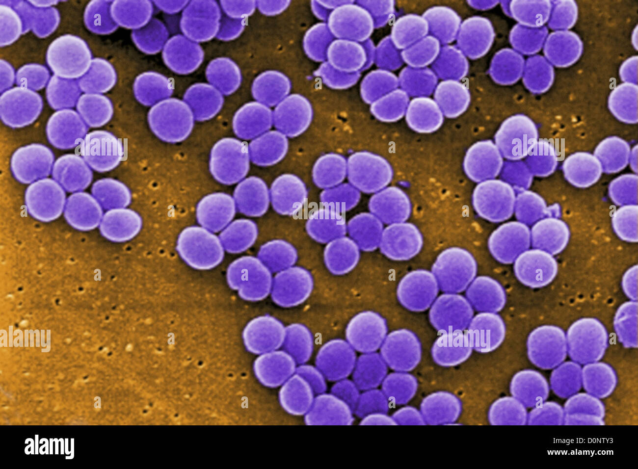 Unter hoher Vergrößerung zeigt 10.000 x dieses scanning Electron Schliffbild (SEM) Stamm Staphylococcus Aureus-Bakterien genommen Stockfoto