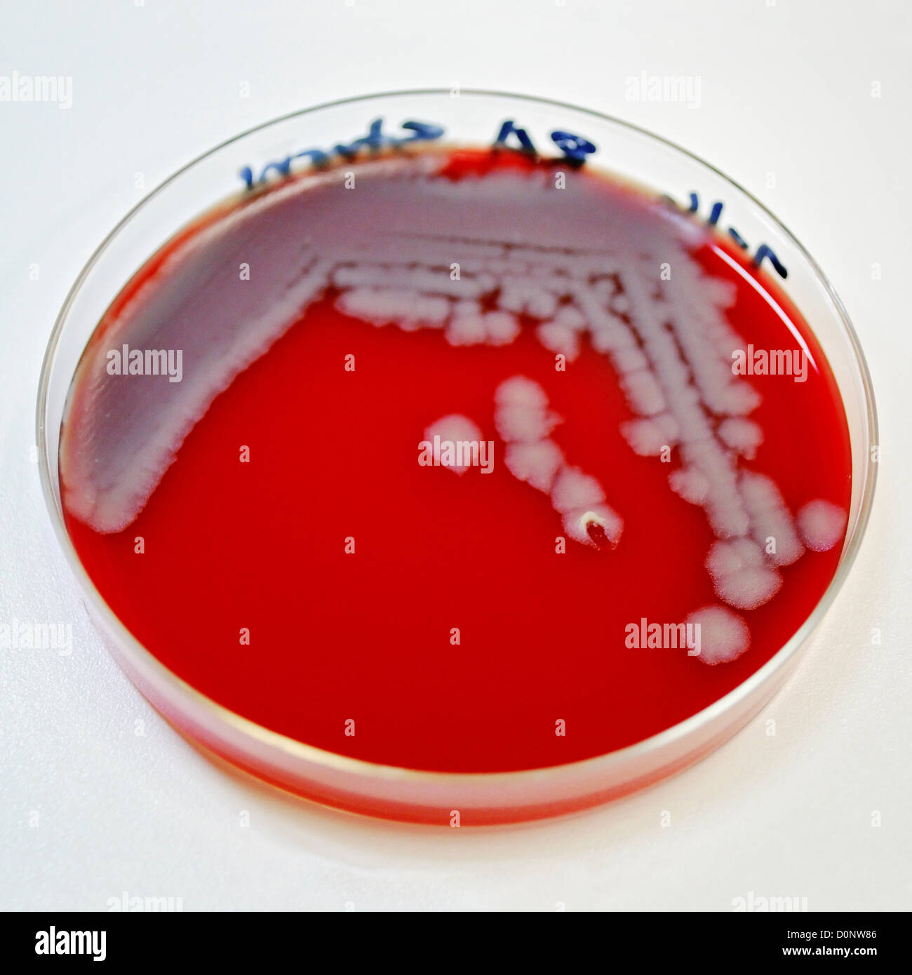 Zahlen Bacillus Anthracis Bakterienkolonien, die erlaubt hatte, wachsen auf Schafe? s Blutagar (SBA) innerhalb von 24 Stunden. Hinweis Stockfoto