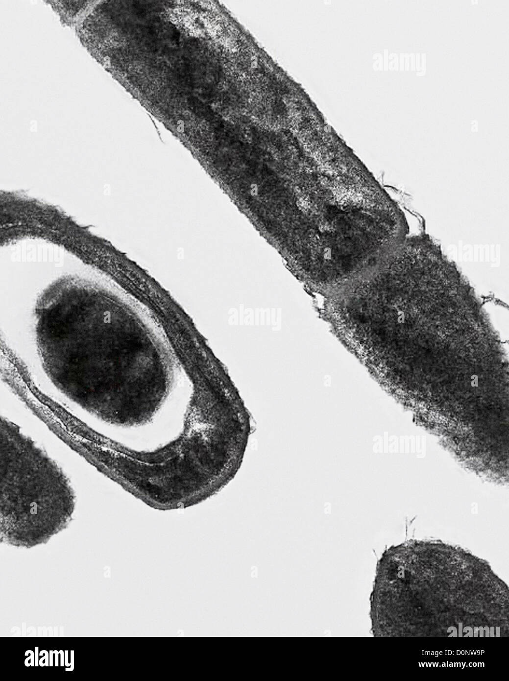 Eine Übertragung Elektronen mikrographische (TEM) Bild Bacillus Anthracis Milzbrand Kultur zeigt Zellteilung (rechts) Sporen (links). Stockfoto
