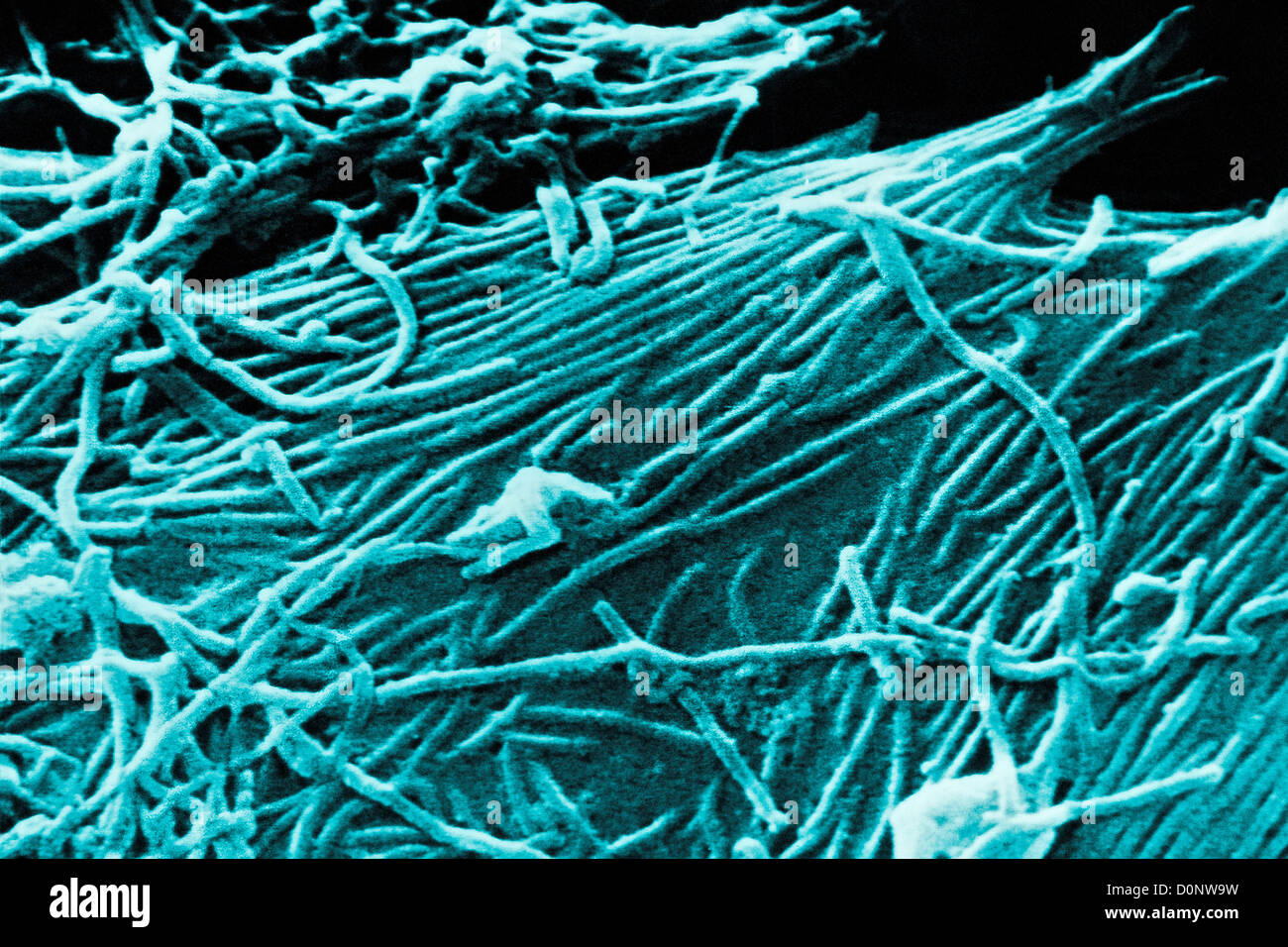 Dieser Scan Elektron Schliffbild (SEM) zeigt Nummer Ebola Virionen. Ebola hämorrhagisches Fieber (Ebola-HF) ist schwere oft tödlich Stockfoto
